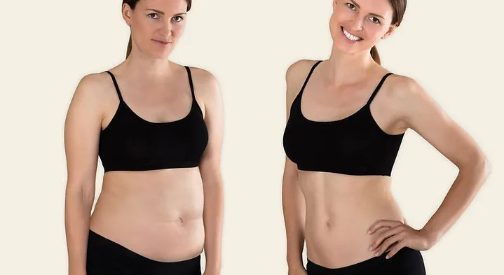 Ultrasonic Lipo Cavitation treatment