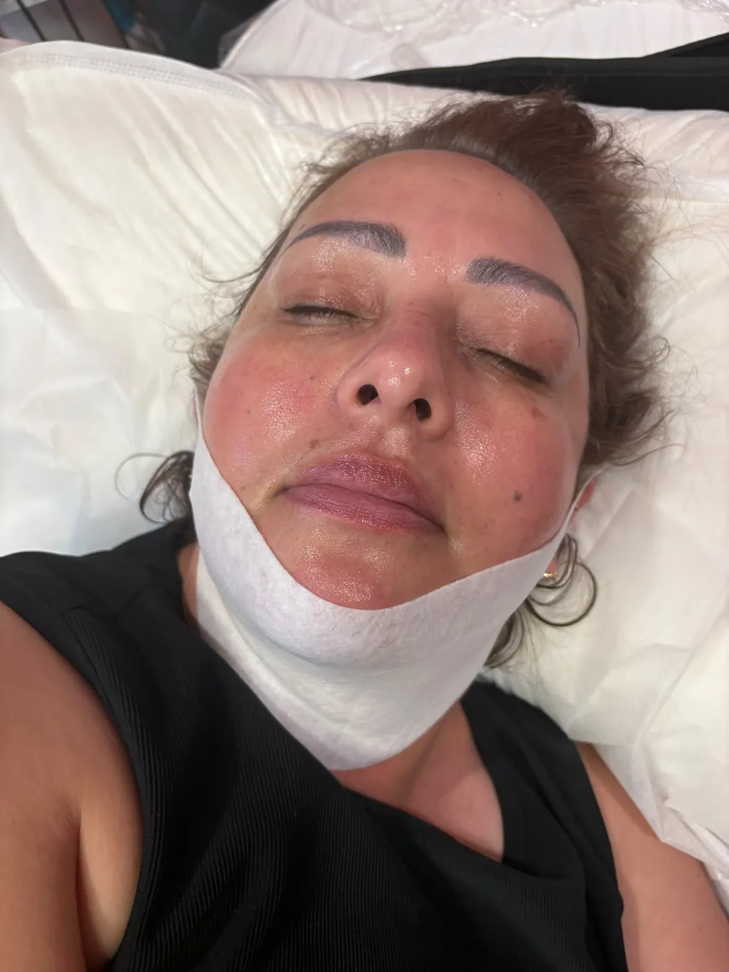Real Client Treatment Result