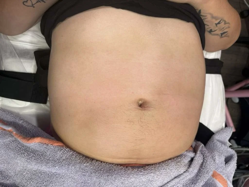 Real Client Treatment Result