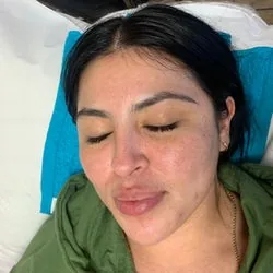 Real Client Treatment Result