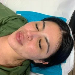 Real Client Treatment Result