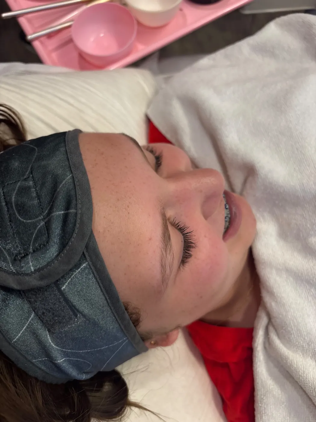 Real Client Treatment Result