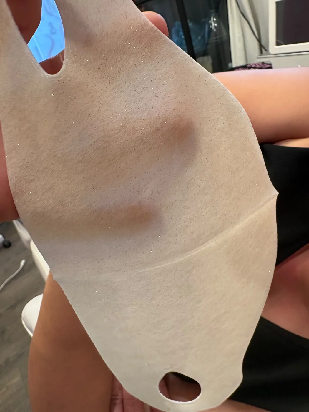 Real Client Treatment Result