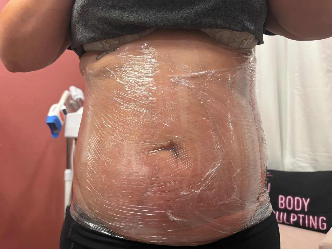 Real Client Treatment Result