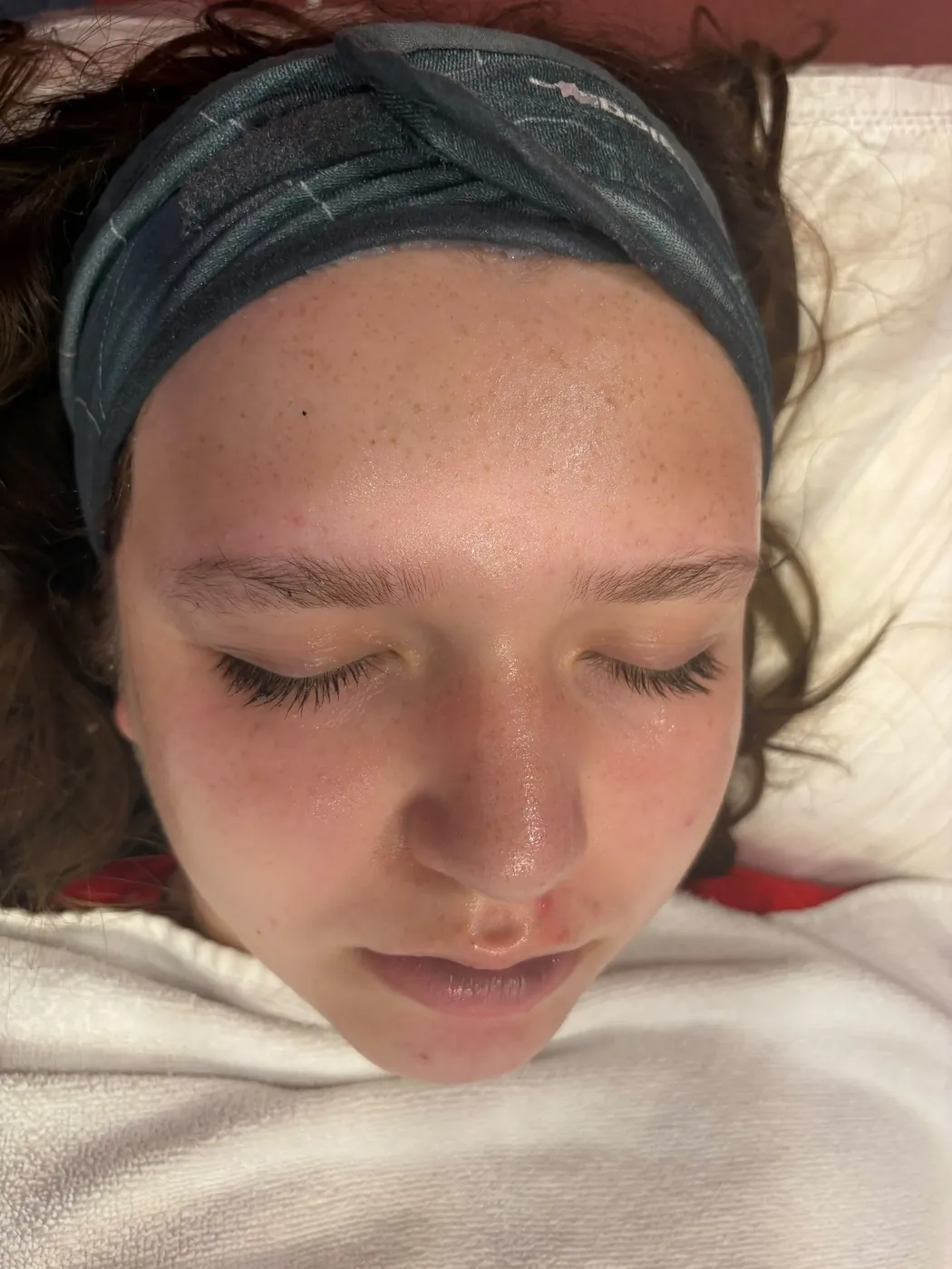 Real Client Treatment Result