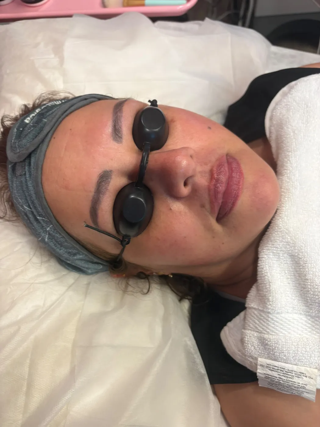 Real Client Treatment Result