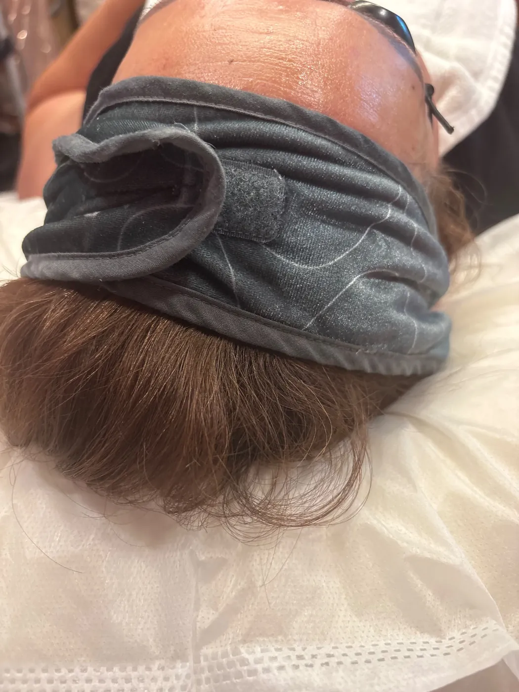 Real Client Treatment Result
