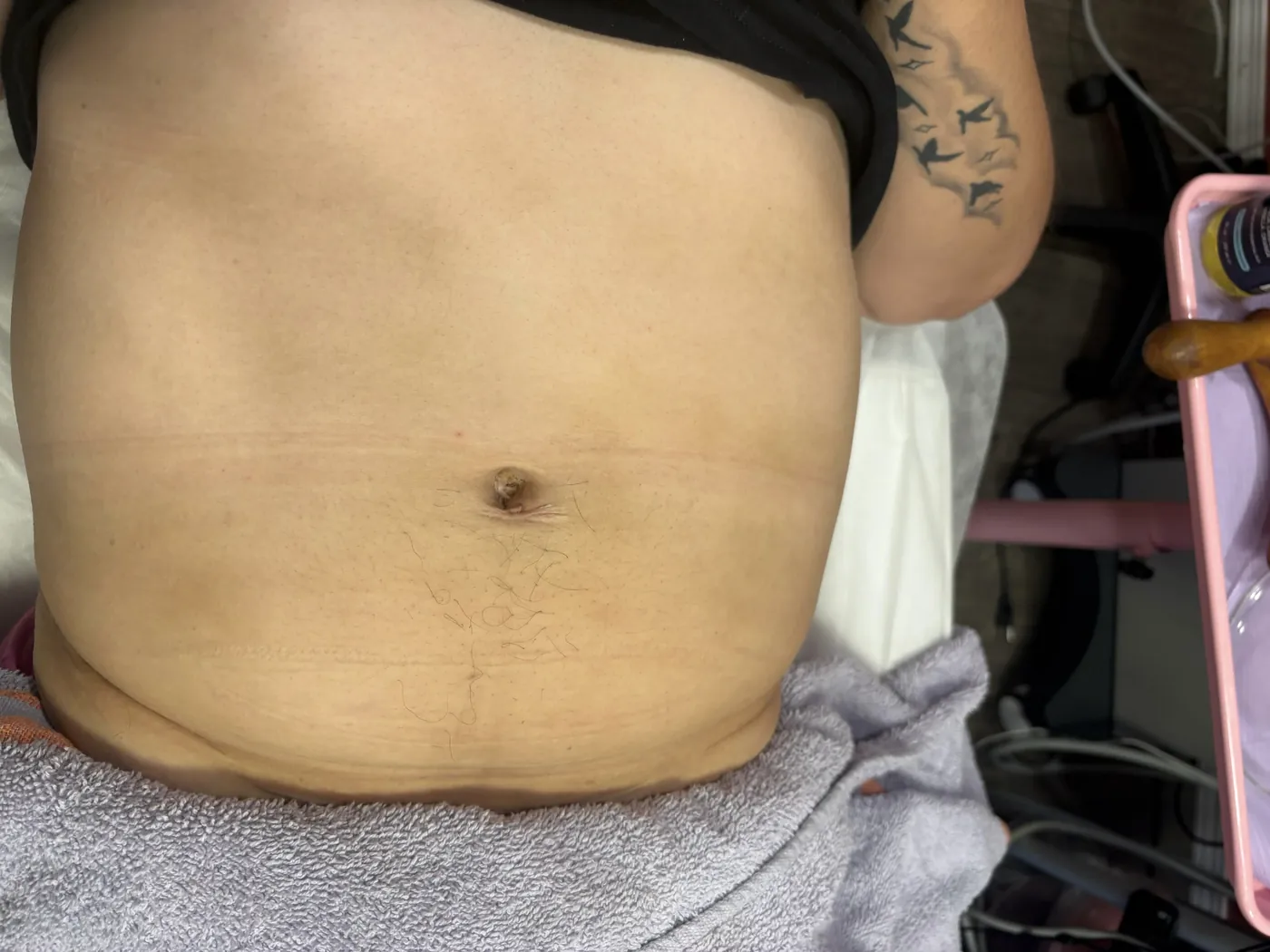 Real Client Treatment Result