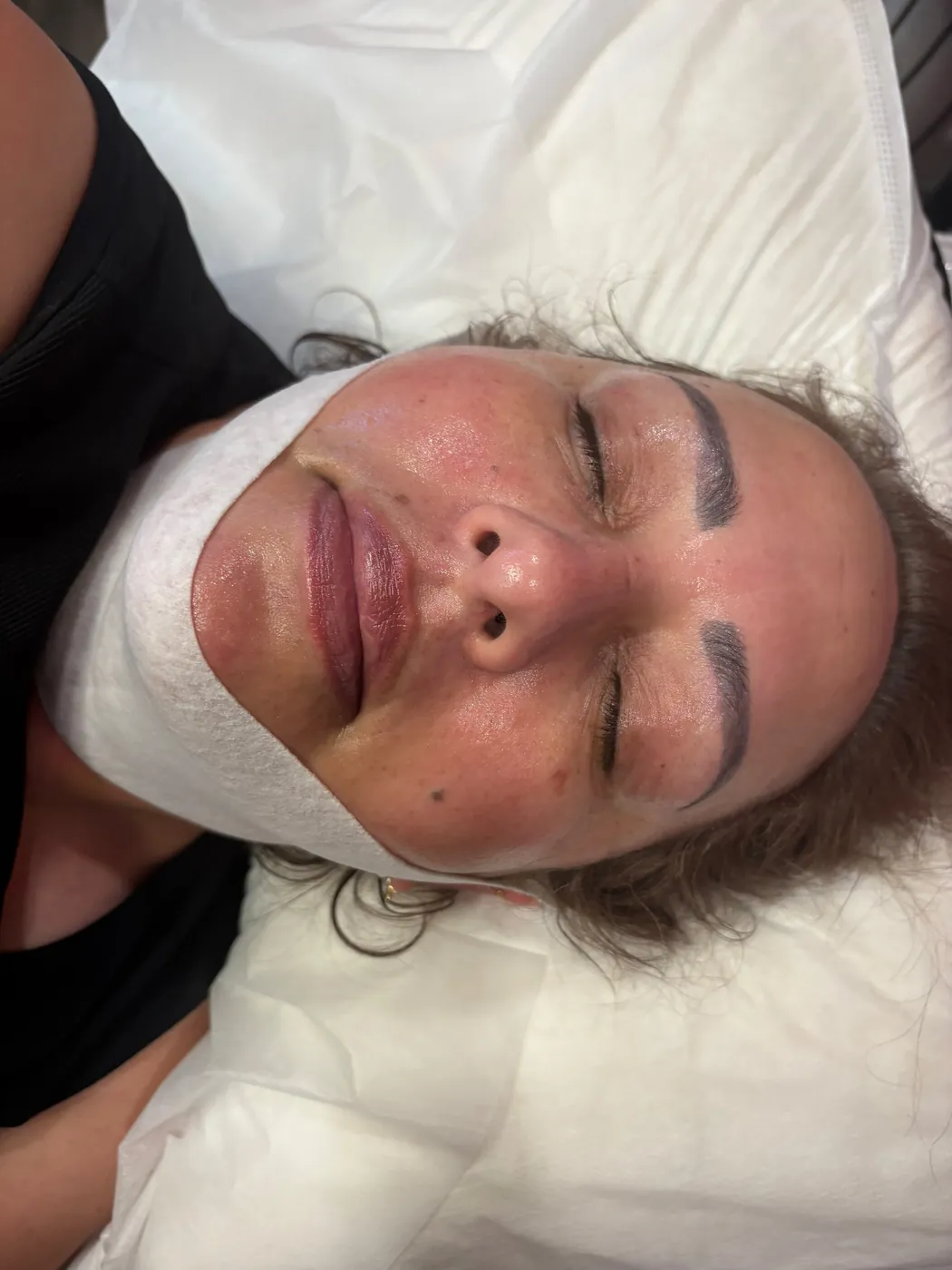 Real Client Treatment Result