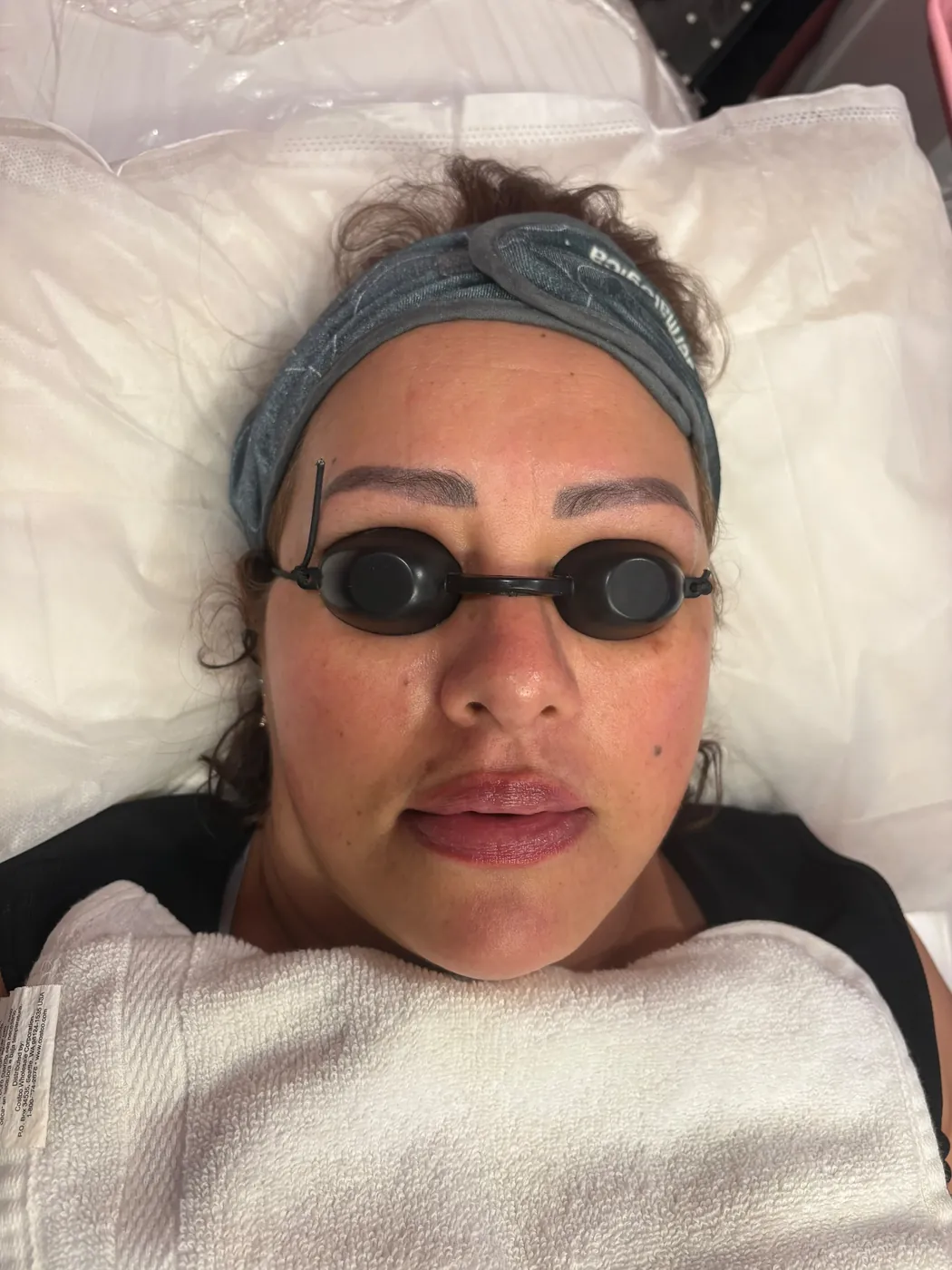 Real Client Treatment Result