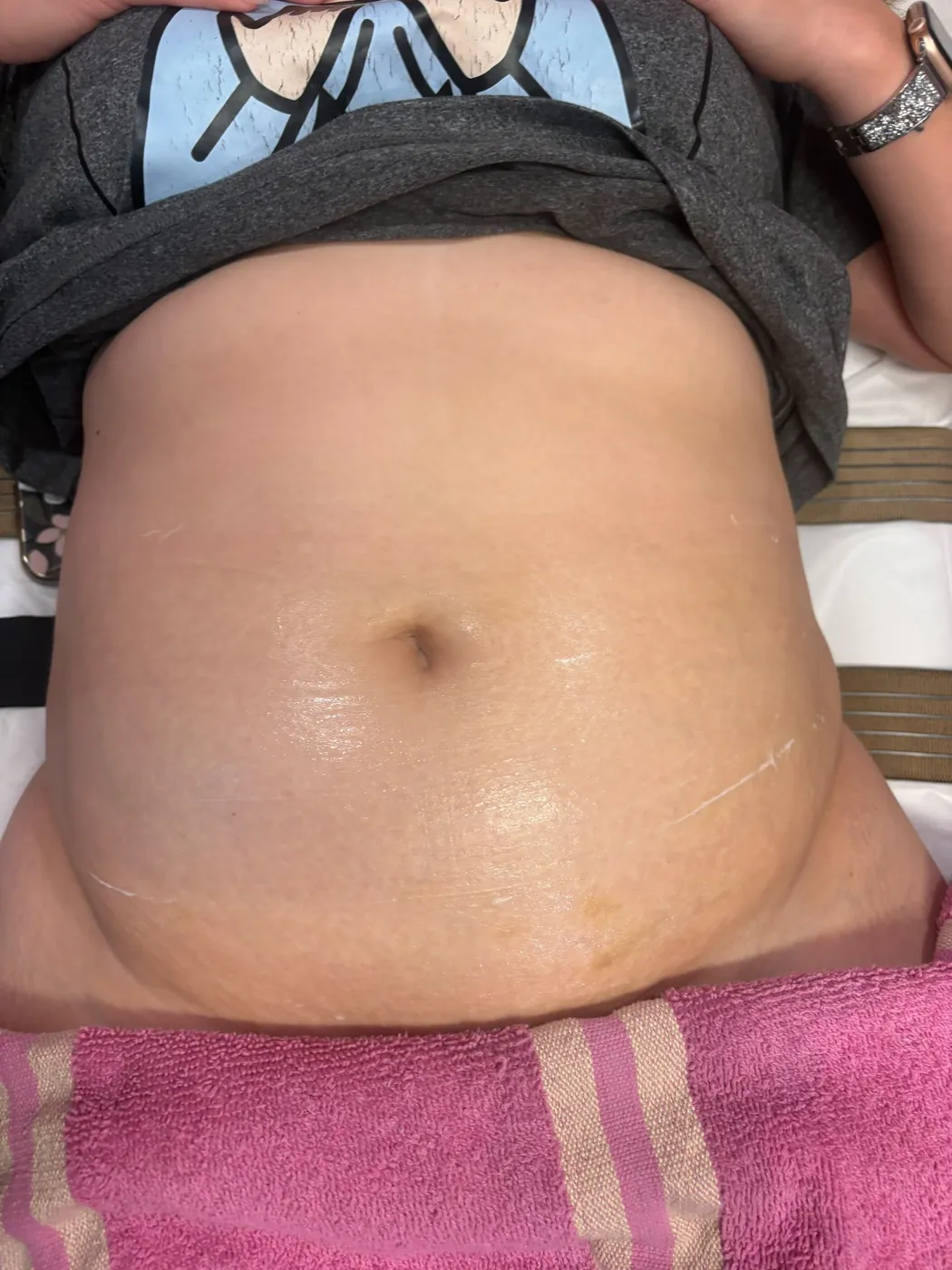 Real Client Treatment Result